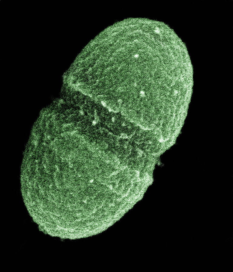 ドッグフードの成分として用いられる「エンテロコッカス」の電子顕微鏡拡大写真