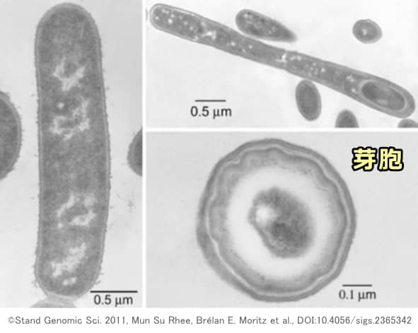 バチルス・コアグランス36D1の顕微鏡写真～芽胞（endospore）の形成過程を見て取れる