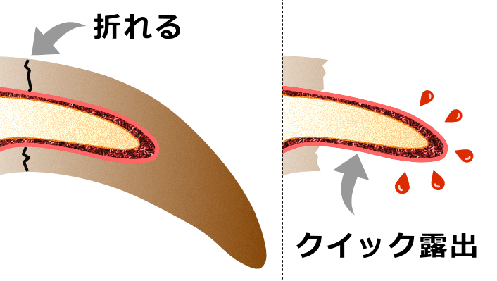 犬の爪が折れるとクイックからキャップ（爪甲）が抜けたような状態になる