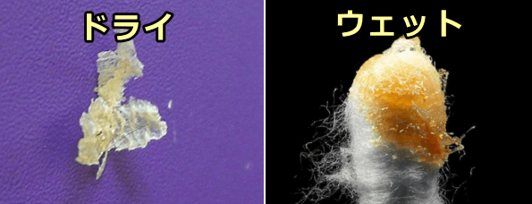 人間の耳垢にはドライタイプとウェットタイプとがある