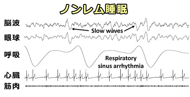 犬の睡眠における「ノンレム睡眠相」の生理学的な特徴