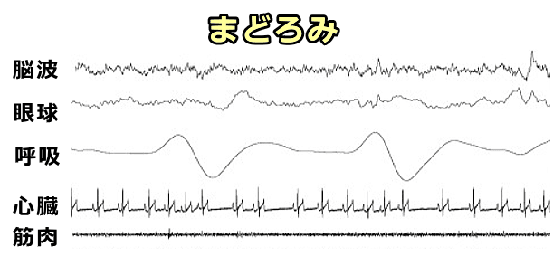 犬の睡眠における「まどろみ相」の生理学的な特徴