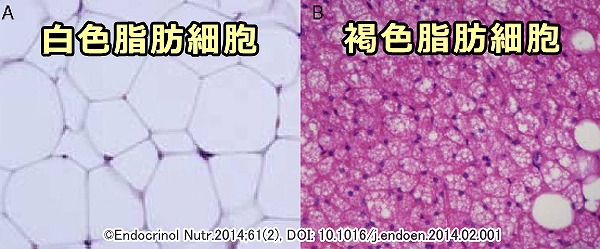 白色脂肪細胞と褐色脂肪細胞の顕微鏡比較写真